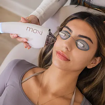 Moxi-resurfacing-treatment-at-splendid-skin-medspa-mobile-view