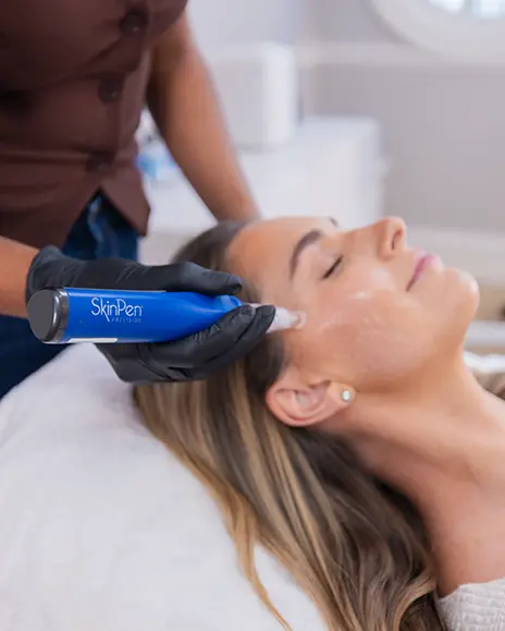 microneedling-service