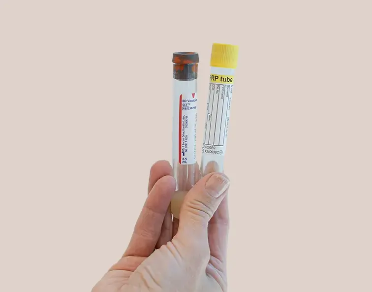 PRF-vials