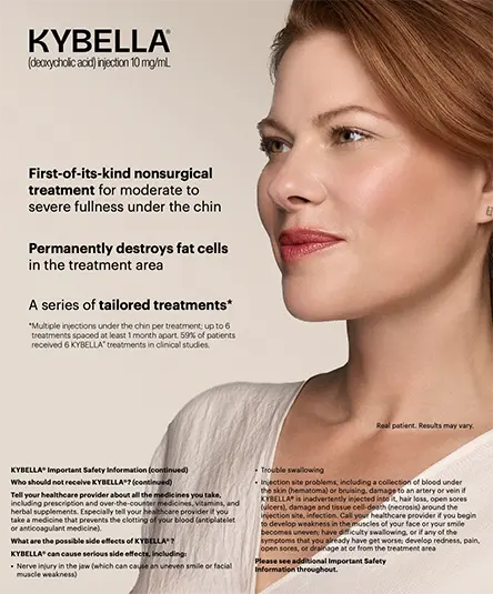 kybella-promo-image