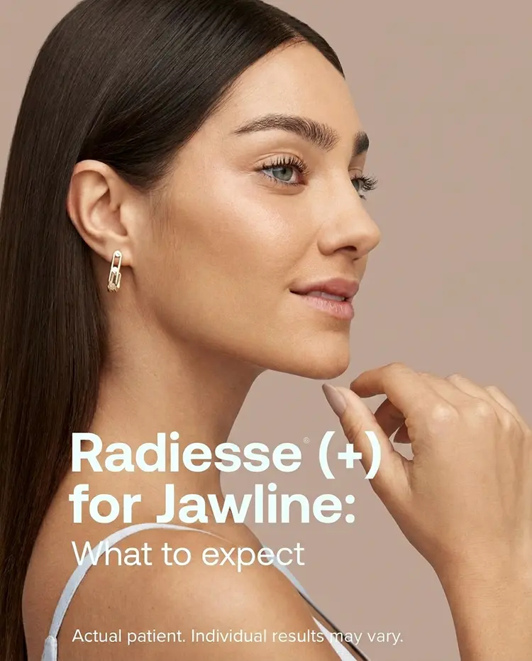 radiesse-brandbox-ad-image