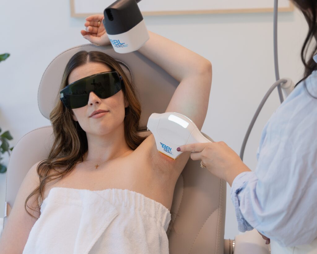 BBL HEROic treatment for underarm skin at Splendid Skin, Franklin, TN